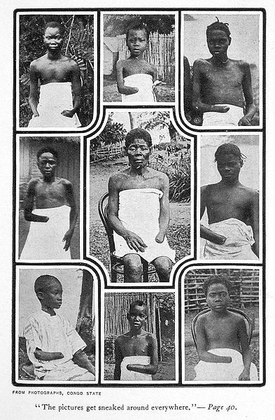 Wikipedia: Congolese children and wives whose fathers failed to meet rubber collection quotas were often punished by having their hands cut off.